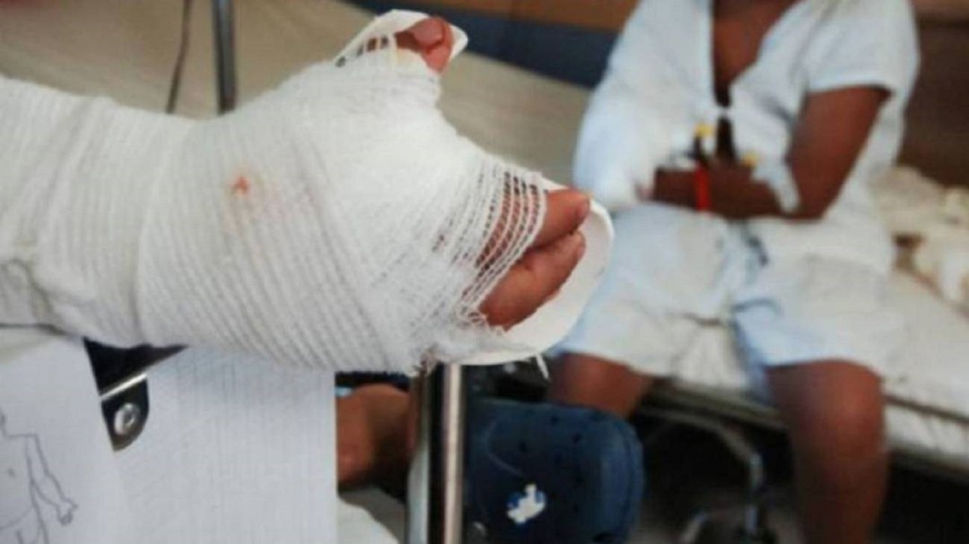 En Caldas se reportaron 33 casos de lesionados por quemaduras con pólvora