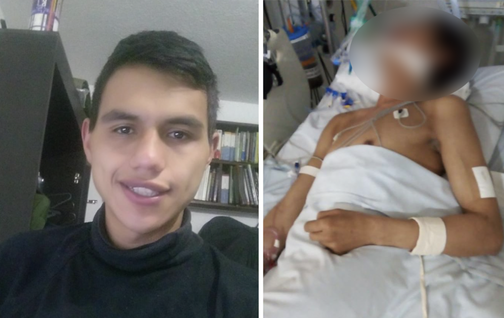 Falleció Jhonatan, el joven atacado salvajemente en Suba