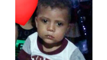 Muere niño de 5 años por golpe en la cabeza