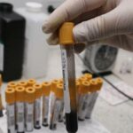 En Cali detectan primer caso de hepatitis de origen desconocido en el país