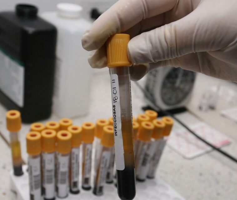 En Cali detectan primer caso de hepatitis de origen desconocido en el país