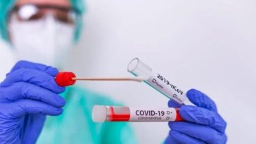 28 nuevos casos de Covid-19 se reportan en Casanare