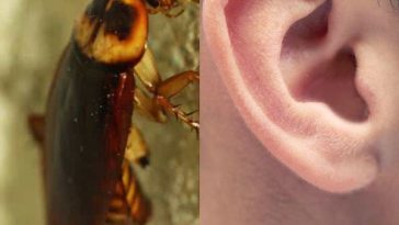 A un hombre se le había metido una cucaracha en el oído, «tenía mordeduras», ocurrió en el Atlántico
