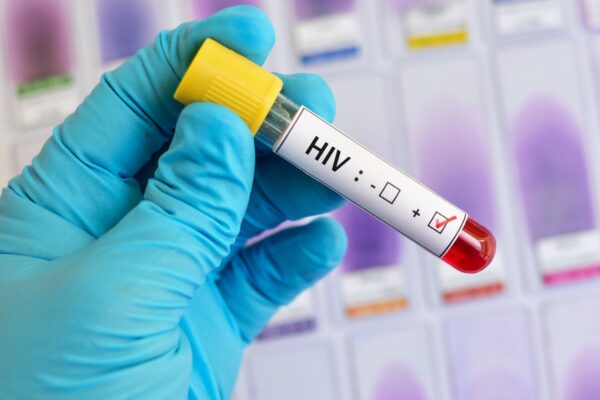 Se disparan niveles de desatención de los pacientes con VIH-Sida: Supersalud