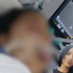 En coma continúa jovencita que se accidentó junto a su esposo el 1º de enero en el sector de Los Tunjos