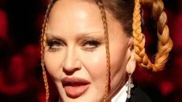 ¿Qué le pasó en la cara a Madonna?