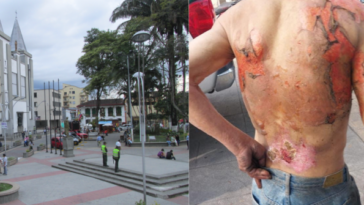Habitante de calle fue quemado al ser rociado con gasolina en Calarcá