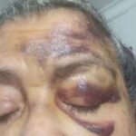 Adulta mayor, de 78 años, brutalmente golpeada por delincuentes en Santa Marta