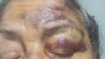 Adulta mayor, de 78 años, brutalmente golpeada por delincuentes en Santa Marta
