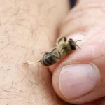 cundianmarca soacha picadura abejas 2