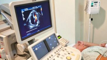 Hospital San Juan de Dios de Armenia ampliará su atención para pacientes en cardiología
