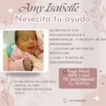 ¡Ayudemos a Amy! La recién nacida necesita cirugías para combatir el mielomeningocele e hidrocefalia