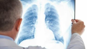 El tabaquismo: la principal causa de cáncer de pulmón y EPOC