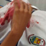 Estudiante del colegio Francisco Molina Sánchez, resultó herido con arma blanca por un compañero