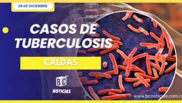 Casos de tuberculosis en Caldas superan las cifras del 2022