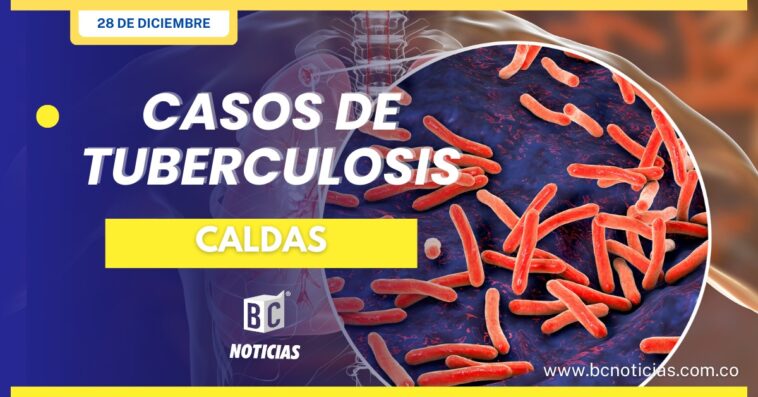 Casos de tuberculosis en Caldas superan las cifras del 2022