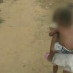 Alarmantes cifras de desnutrición de menores en Colombia: van más de 600 casos en lo corrido de 2024