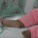 Alarma en Bajo Baudó por muertes de niños asociadas a la desnutrición: van 7 en 2024