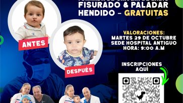 Se acerca la gran jornada para valoración y tratamiento quirúrgico a pacientes con malformaciones cráneo faciales o labio leporino y paladar hendido