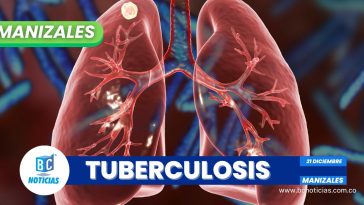 156 casos de tuberculosis se han registrado en las cárceles de Manizales