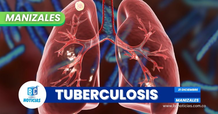 156 casos de tuberculosis se han registrado en las cárceles de Manizales