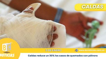 Caldas reduce un 30% los casos de quemados con pólvora en las festividades de fin de año