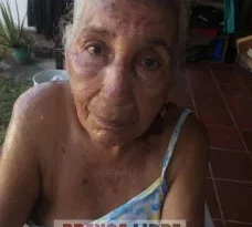 Abuelita perdió su vivienda por incendio en zona rural de Trinidad